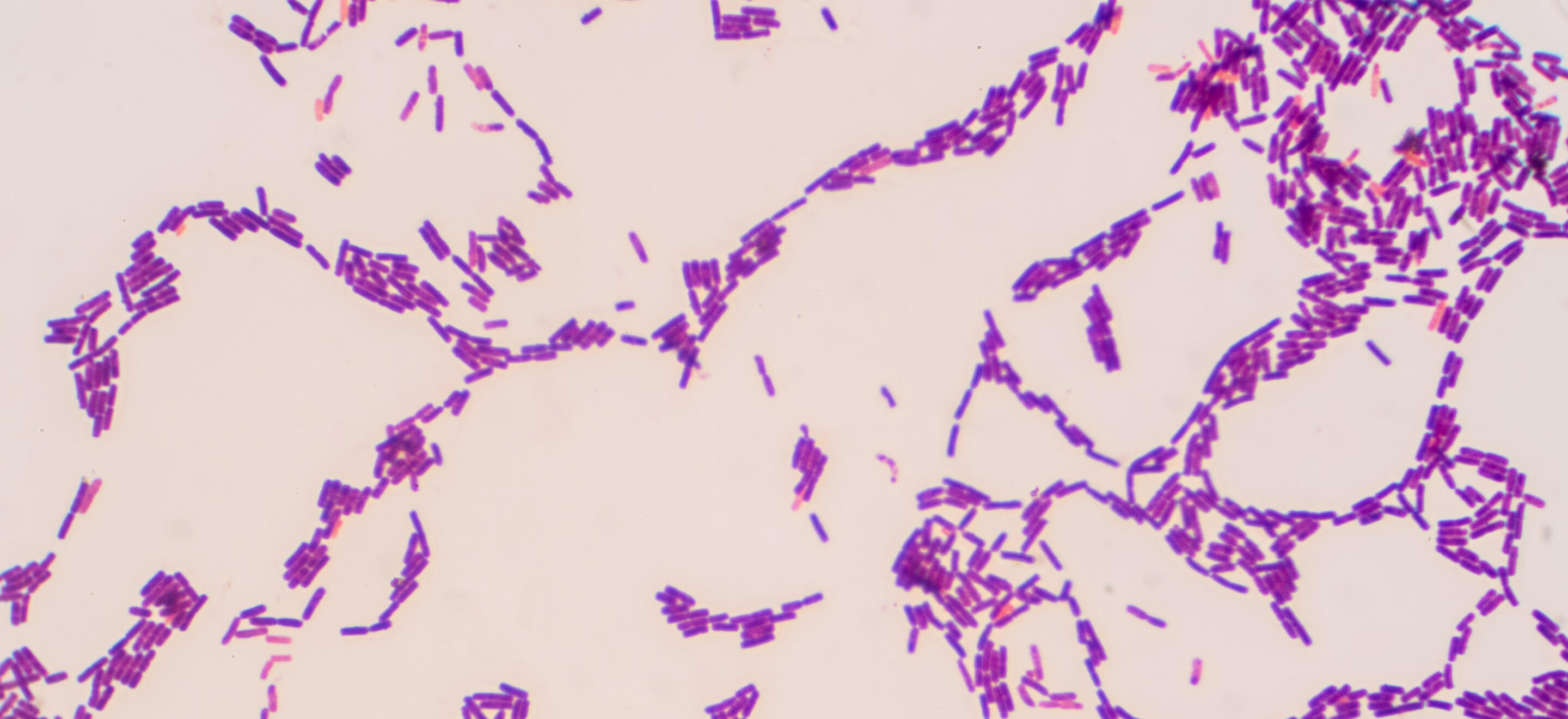 Detection of  Lactobacillus, Diastaticus, Pediococcus, Pectinatus and Megasphaera in Beer.jpg