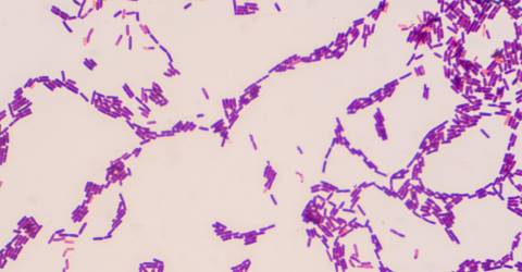 Detection of  Lactobacillus, Diastaticus, Pediococcus, Pectinatus and Megasphaera in Beer