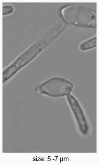 Brettanomyces