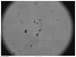 Yeast concentration in beer spoilers