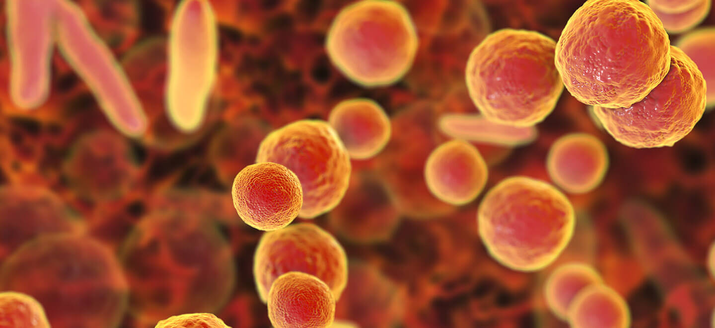 Banner BIOFIRE MYCOPLASMA.jpg
