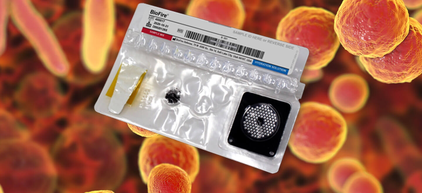 BiIOFIRE MYCOPLASMA POUCH.jpg