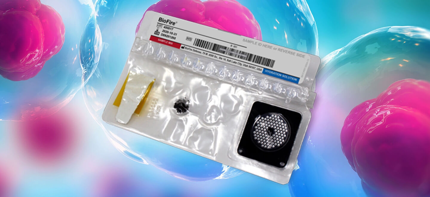 MYCOPLASMA DETECTION IN CELL THERAPY SAMPLES.jpg